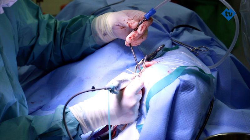 Čeští lékaři přišli s vylepšeným implantátem na principu kostního vedení